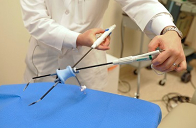 Mini-Gastric Bypass